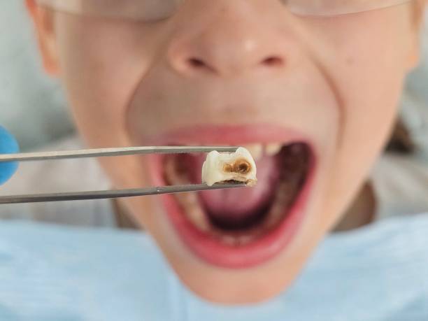 Best Emergency Care for Gum Disease in Gardner, KS